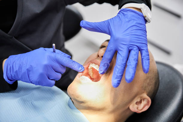Best Emergency Dentist for Lost Fillings or Crowns in USA